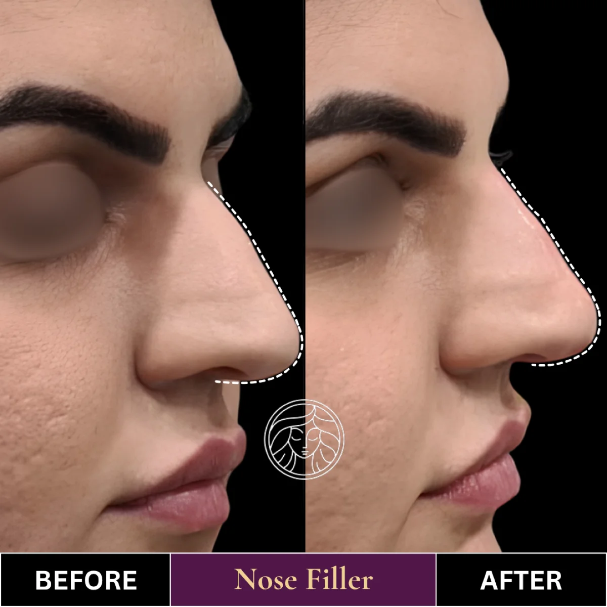 Before and after result 1