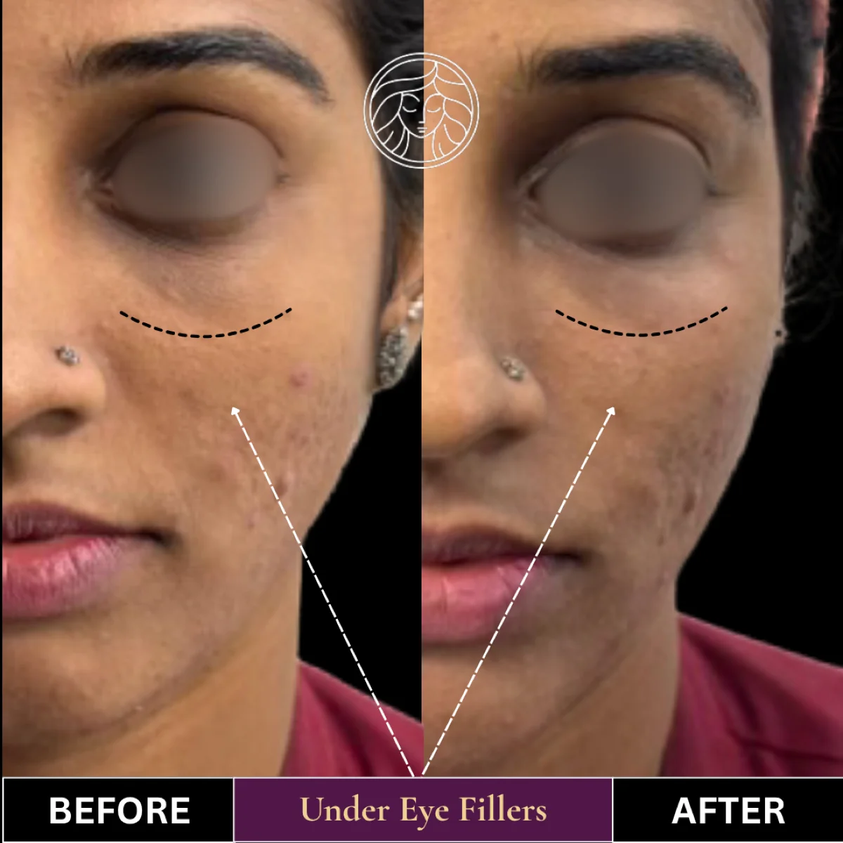 Before and after result 14
