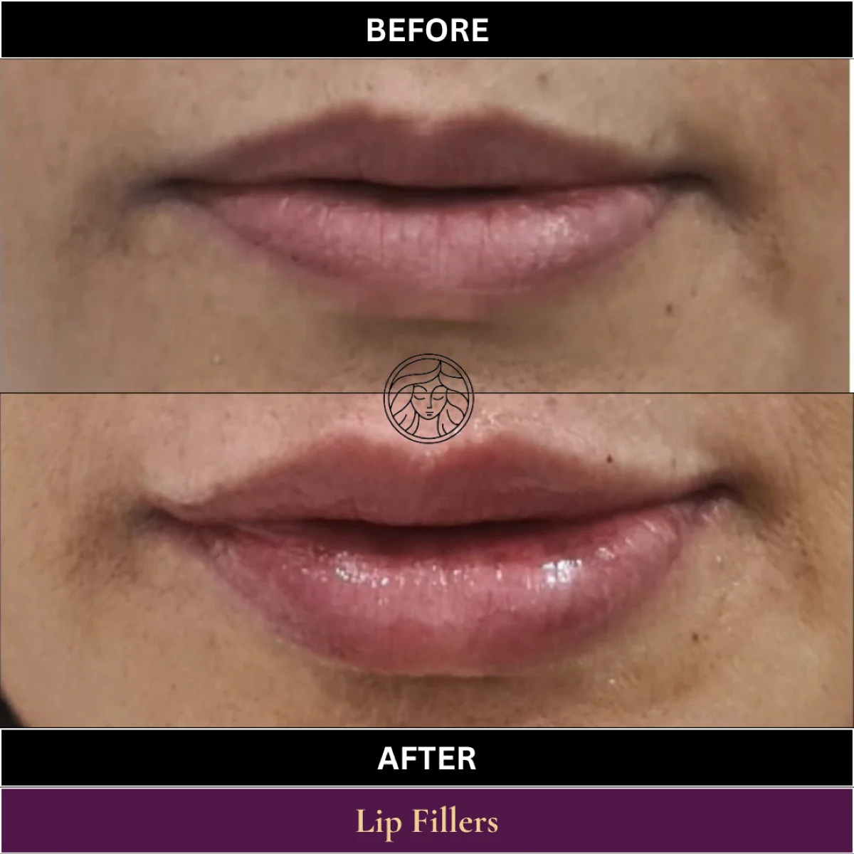 Before and after result 2