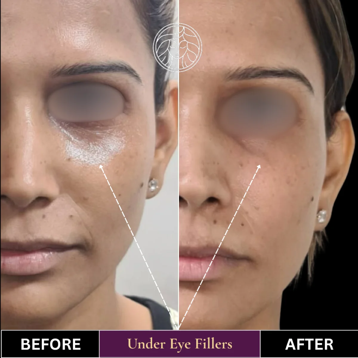 Before and after result 5