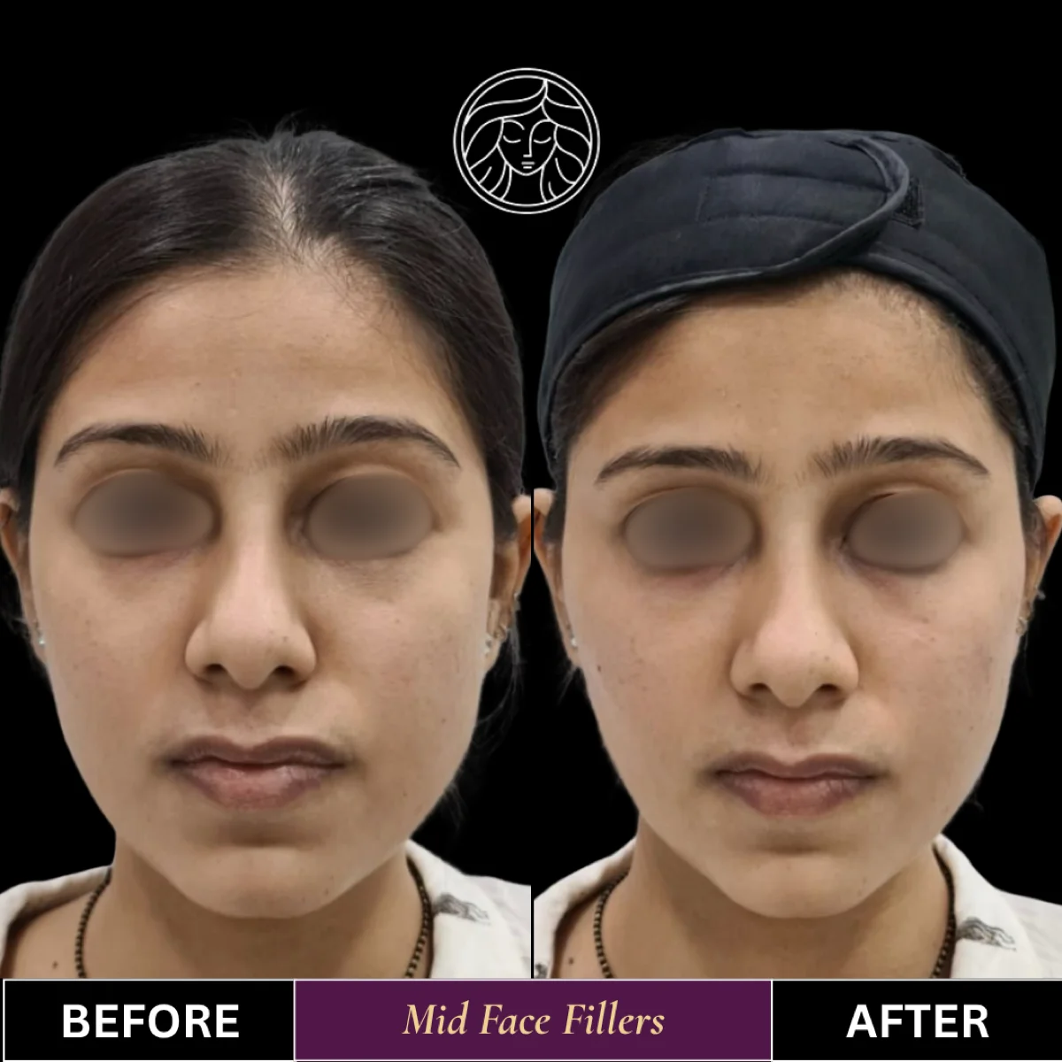 Before and after result 7