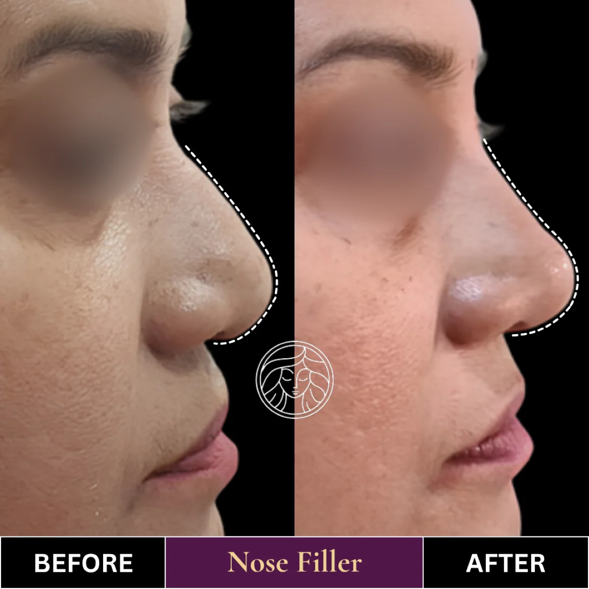 Before and after result 8