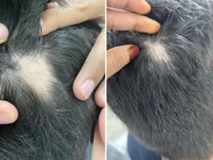 Scalp & Hair